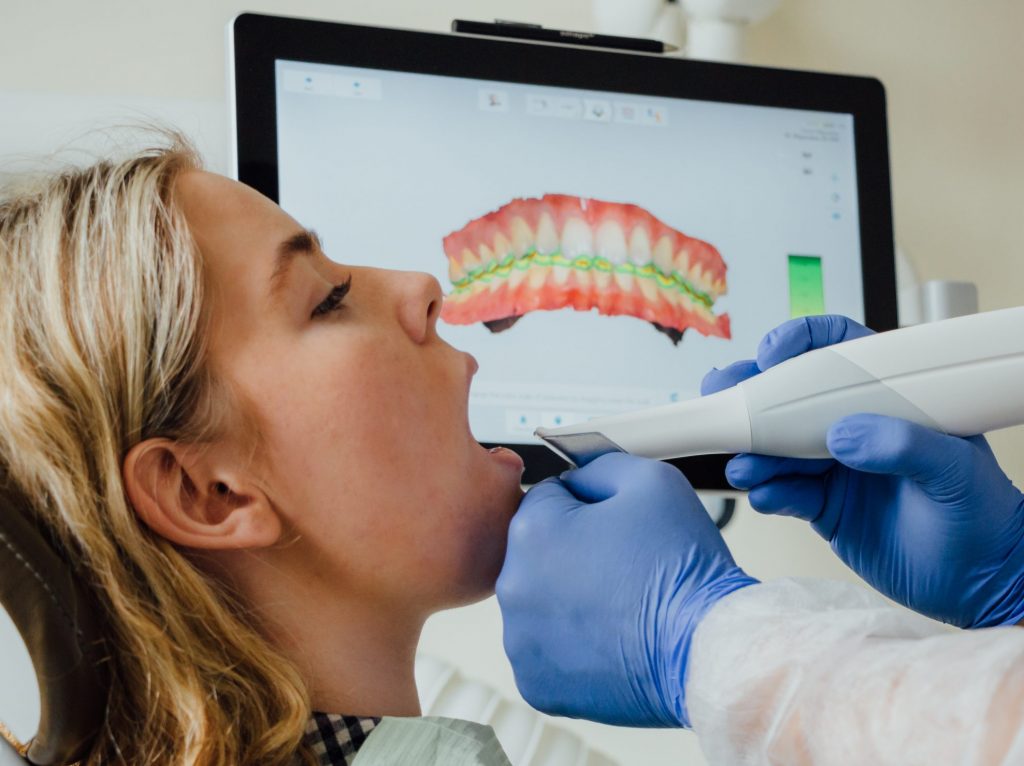 dantų protezavimas skaitmeninis dantų skenavimas 3shape
