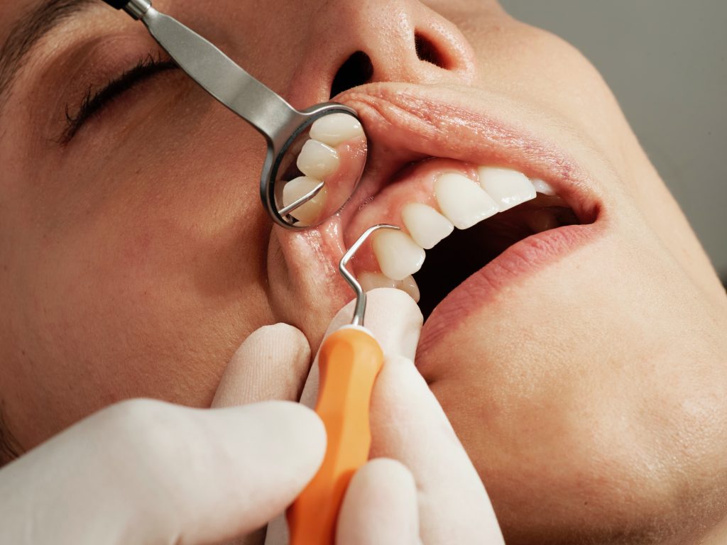 dantų traumų gydymas