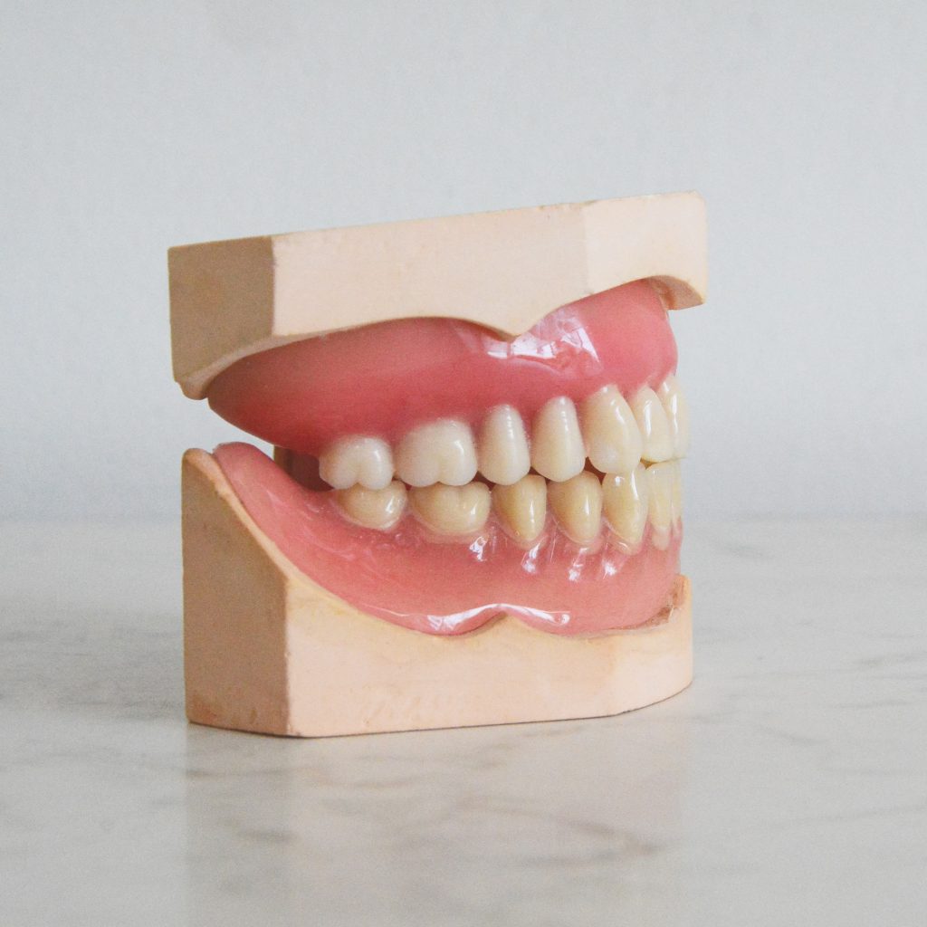 periodontologija dantenos kaina vilnius