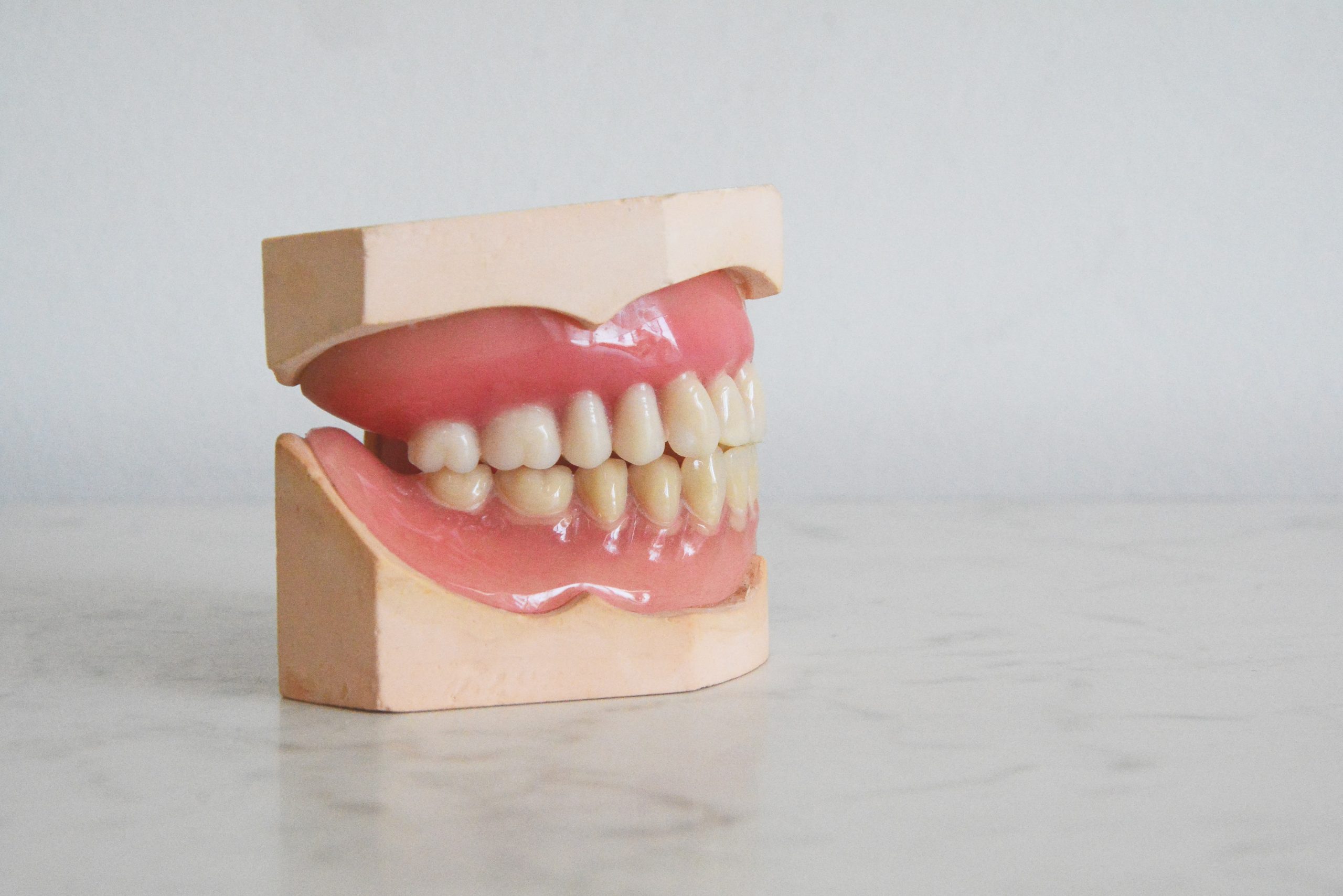 gyvenimas su dantų protezais