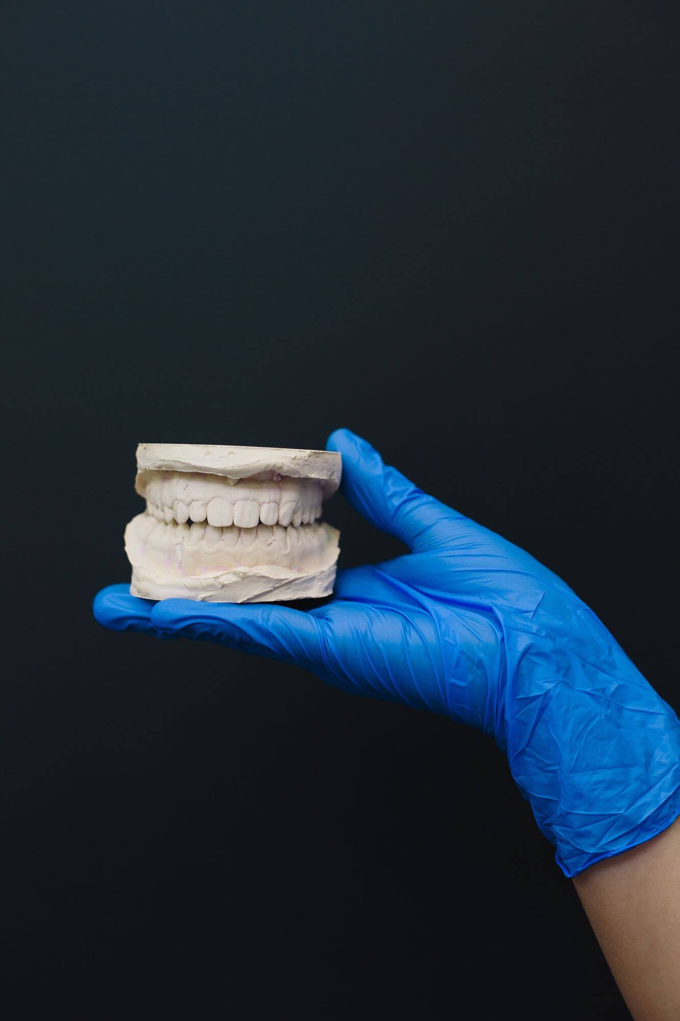 dantų implantacijos modelis