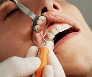 dantų traumų gydymas
