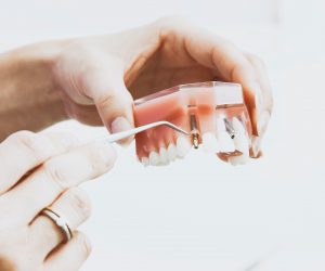 dantų implantavimas vilniuje